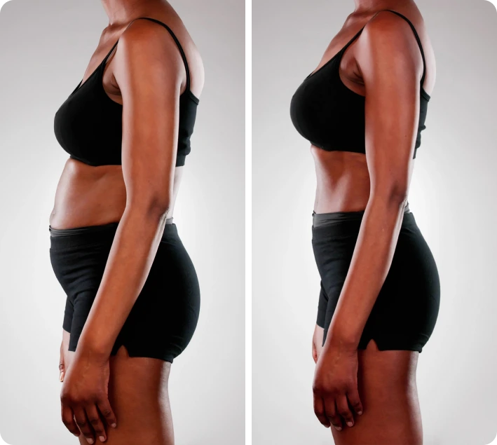 Our Doctor-Supervised Weight-loss Program Banner