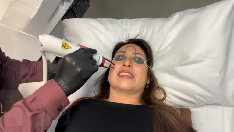 Laser Facials